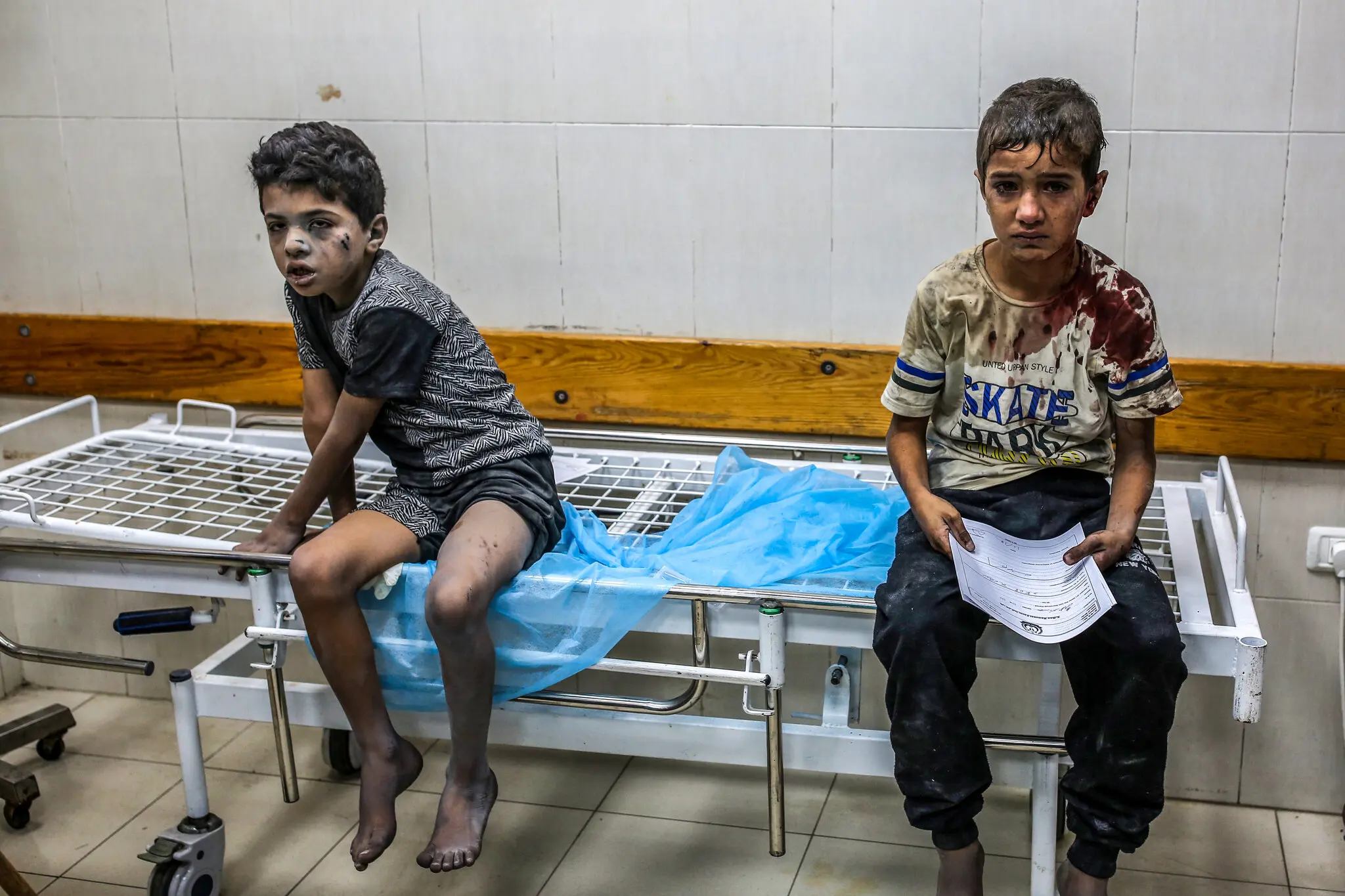 Деякі ветерани військової медицини в секторі Газа кажуть, що умови на перенаселеній і бідній території найгірші, з яких вони коли-небудь бачили